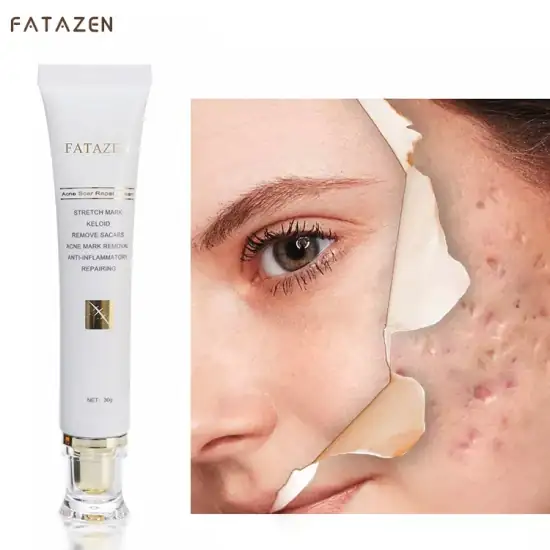 Women-Face-Body-Care-Acne-Treatment-Firming-Fast-Effective-Scar-Removal-Cream FATAZEN, Votre allié beauté pour une peau parfaite, Vergetures, Cicatrices au visages – Image 1