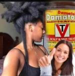 Damatol, Soigne et protège votre cuir chevelu et votre peau