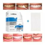 Lanbena, l'essence blanchissante pour dents – Image 2