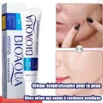 Crème anti-acné BIOAQUA, Réduisez visiblement les imperfections et unifie votre teint, Formulée pour purifier et régénérer votre peau