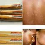 Pack de 3 Pièces, Funbact-A, Triple action contre les mycoses, les bactéries et les inflammations, Soulagez rapidement les irritations cutanées