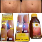 Vergeliss 2 Traitement Intensif Anti-Vergetures - Réduit visiblement les vergetures existantes - Tous types de peau - 125 ml
