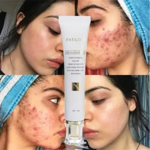 Crème Réparatrice FATAZEN 30g – Élimine les Cicatrices, Marques d’Acné et Vergetures, Soin Anti-Inflammatoire & Régénérant