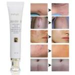 Crème Réparatrice FATAZEN 30g – Élimine les Cicatrices, Marques d’Acné et Vergetures, Soin Anti-Inflammatoire & Régénérant – Image 5