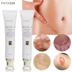 Crème Réparatrice FATAZEN 30g – Élimine les Cicatrices, Marques d’Acné et Vergetures, Soin Anti-Inflammatoire & Régénérant – Image 4
